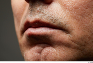 HD Face Skin Benito Romero face lips mouth scar skin…